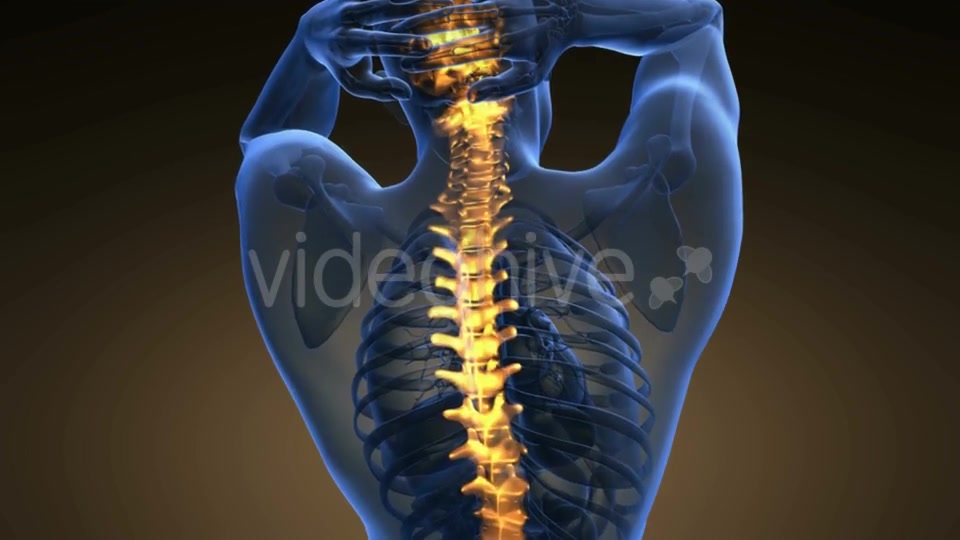 Backache In Back Bones Videohive 18535680 Motion Graphics Image 3