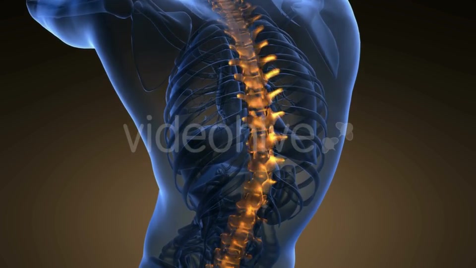 Backache In Back Bones Videohive 18535680 Motion Graphics Image 7