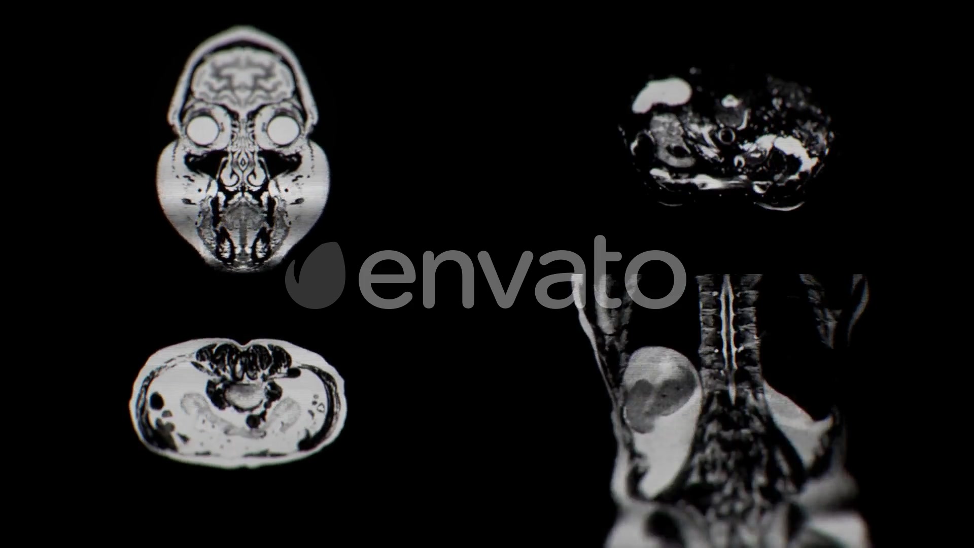 Body Scans (Grunge Backgrounds) Videohive 22825437 Motion Graphics Image 4