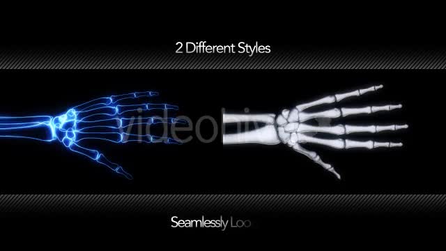 Bones X Ray of Human Hand Videohive 11445646 Motion Graphics Image 1