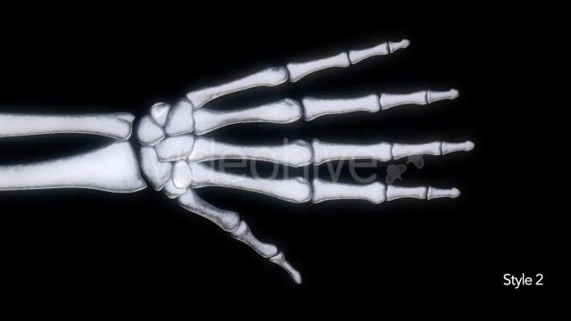 Bones X Ray of Human Hand Videohive 11445646 Motion Graphics Image 10