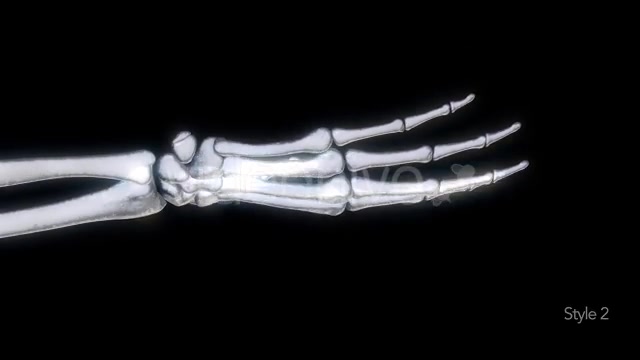 Bones X Ray of Human Hand Videohive 11445646 Motion Graphics Image 11