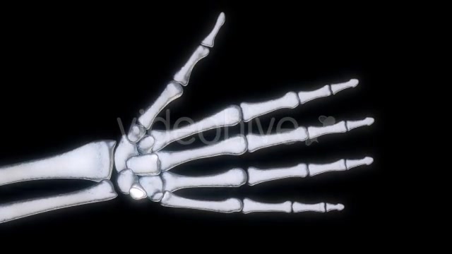 Bones X Ray of Human Hand Videohive 11445646 Motion Graphics Image 12