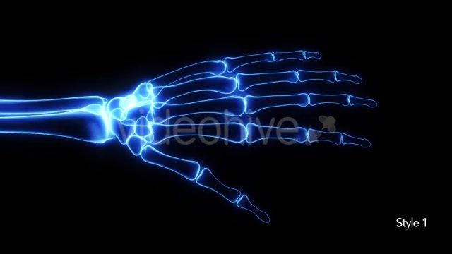 Bones X Ray of Human Hand Videohive 11445646 Motion Graphics Image 4