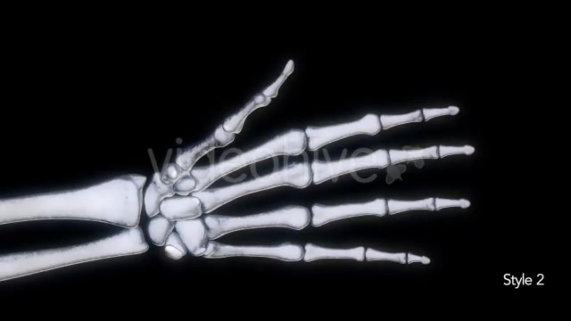 Bones X Ray of Human Hand Videohive 11445646 Motion Graphics Image 8