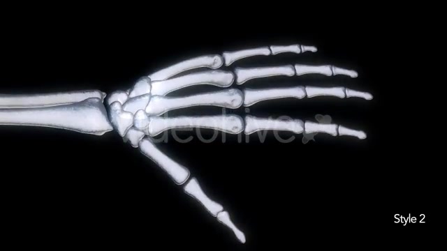 Bones X Ray of Human Hand Videohive 11445646 Motion Graphics Image 9