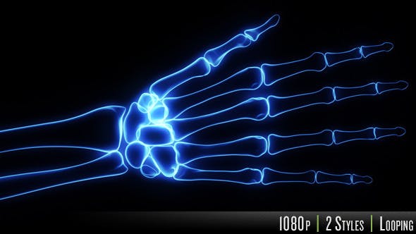 Bones X Ray of Human Hand - Videohive Download 11445646
