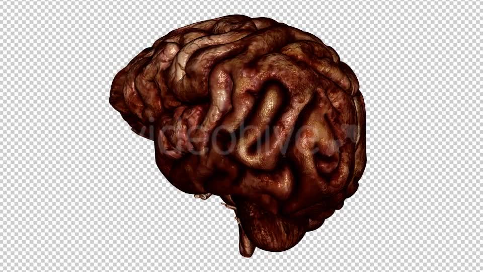 Brain Bloody Videohive 10640676 Motion Graphics Image 7