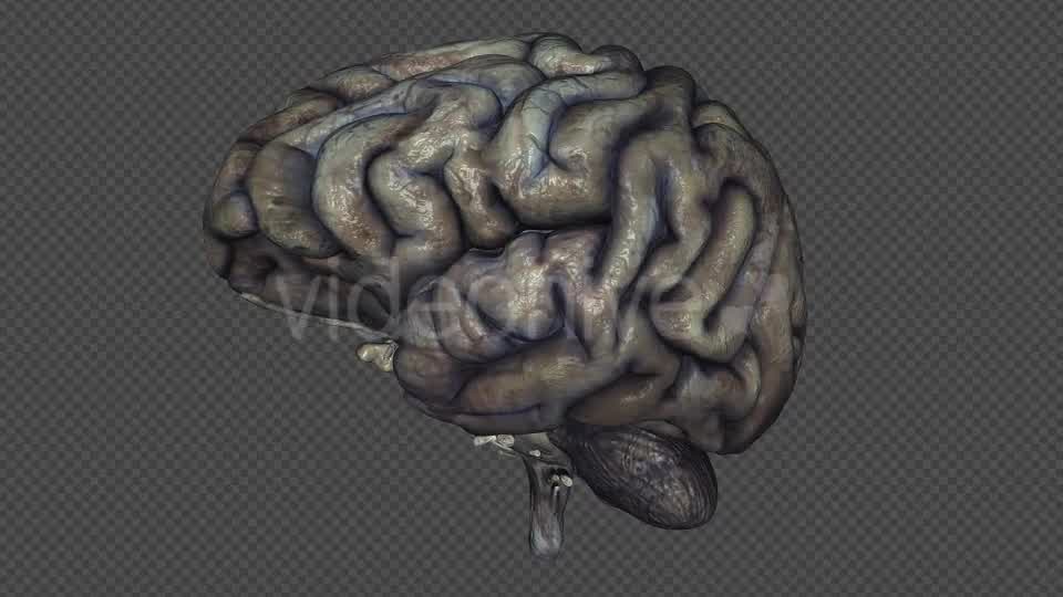 Brain Rotten Videohive 10640598 Motion Graphics Image 8