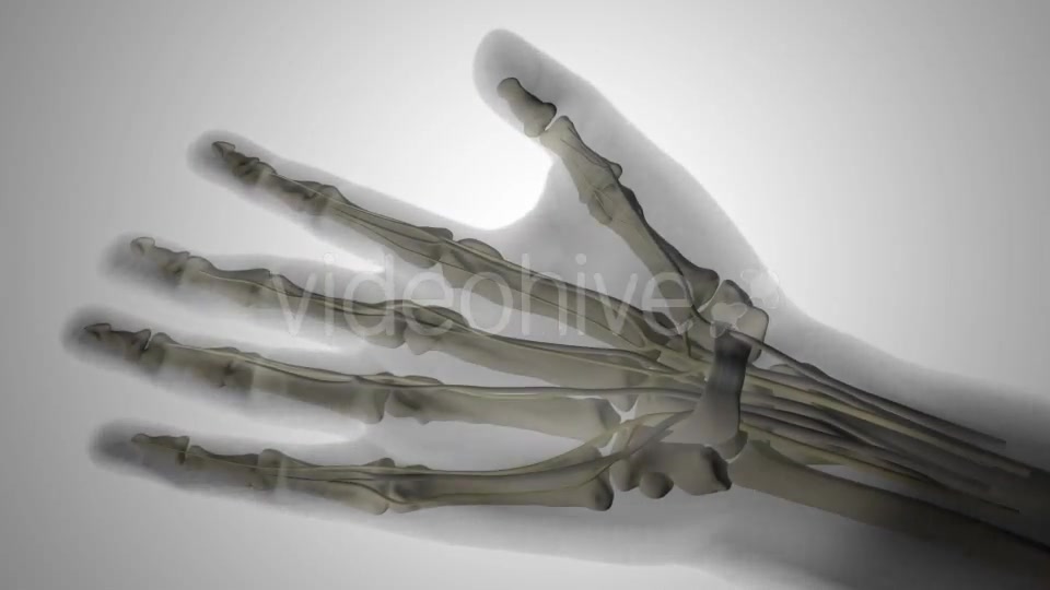 Carpal Tunnel Syndrome Videohive 20207663 Motion Graphics Image 2