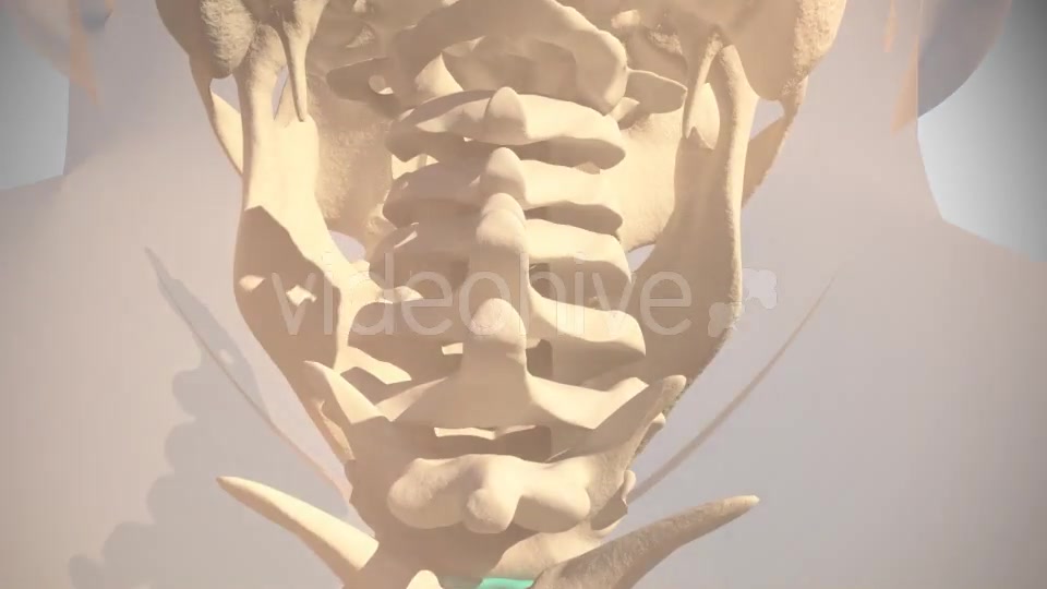Cervical Hernia Videohive 14830431 Motion Graphics Image 2