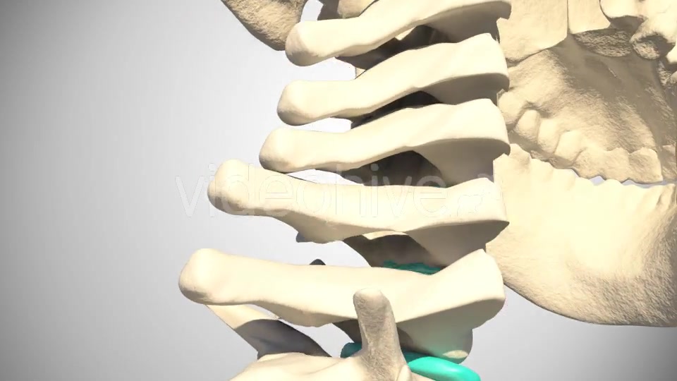 Cervical Hernia Videohive 14830431 Motion Graphics Image 3