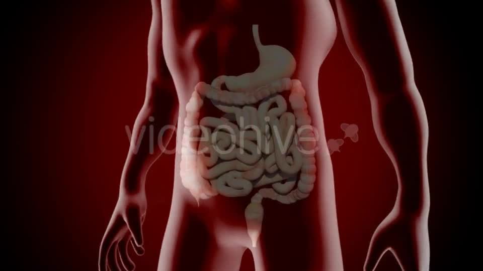 Colon Polypectomy Videohive 19660610 Motion Graphics Image 1