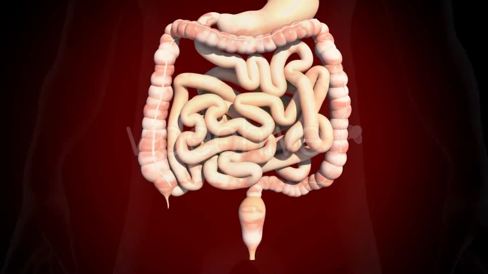 Colon Polypectomy Videohive 19660610 Motion Graphics Image 2