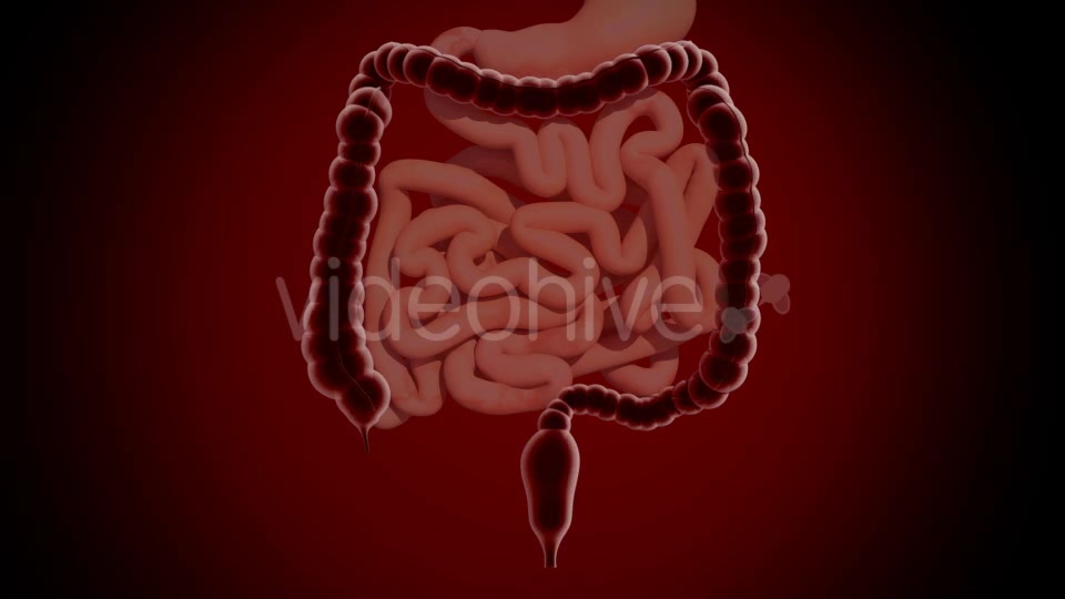 Colon Polypectomy Videohive 19660610 Motion Graphics Image 3
