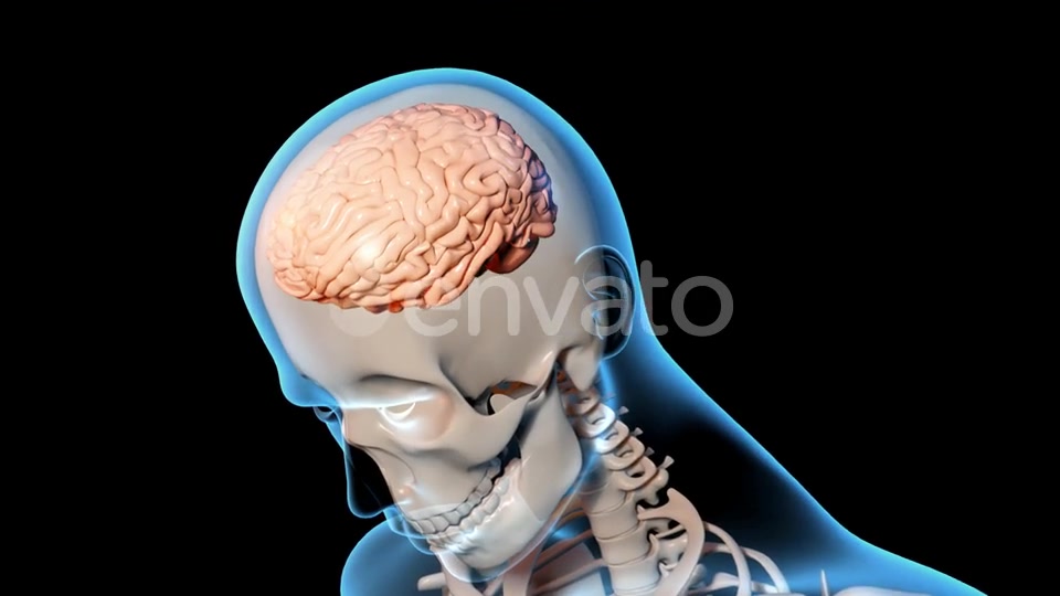 Concussion Traumatic Brain Injury Videohive 23415163 Motion Graphics Image 7