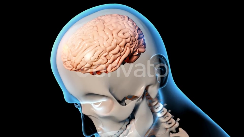 Concussion Traumatic Brain Injury Videohive 23415163 Motion Graphics Image 8