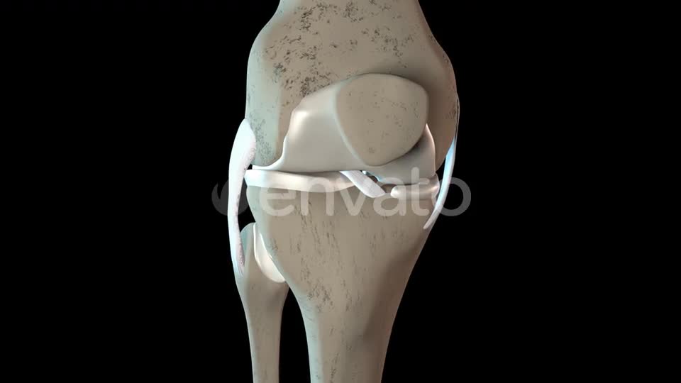 Damage To The Knee Cartilage Tissue Videohive 23324689 Motion Graphics Image 1