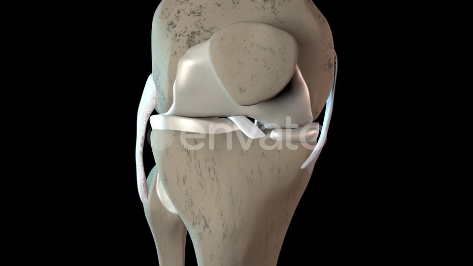 Damage To The Knee Cartilage Tissue Videohive 23324689 Motion Graphics Image 2