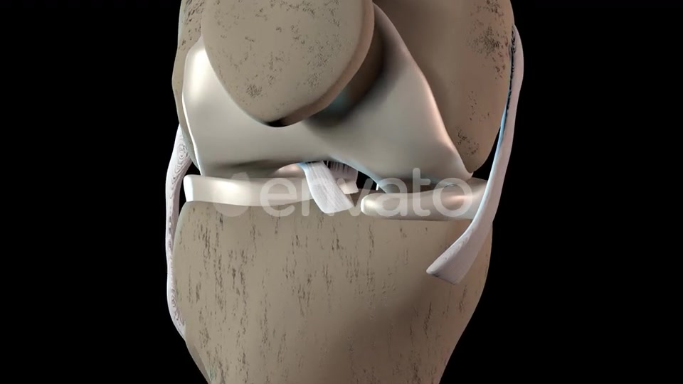 Damage To The Knee Cartilage Tissue Videohive 23324689 Motion Graphics Image 3