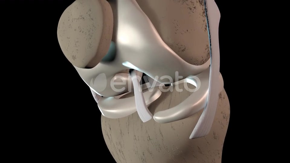 Damage To The Knee Cartilage Tissue Videohive 23324689 Motion Graphics Image 4
