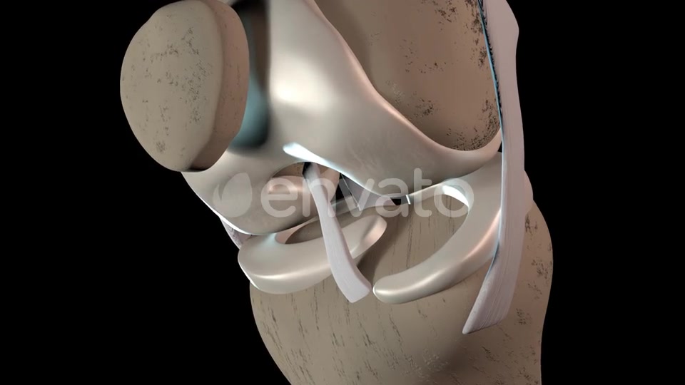 Damage To The Knee Cartilage Tissue Videohive 23324689 Motion Graphics Image 5