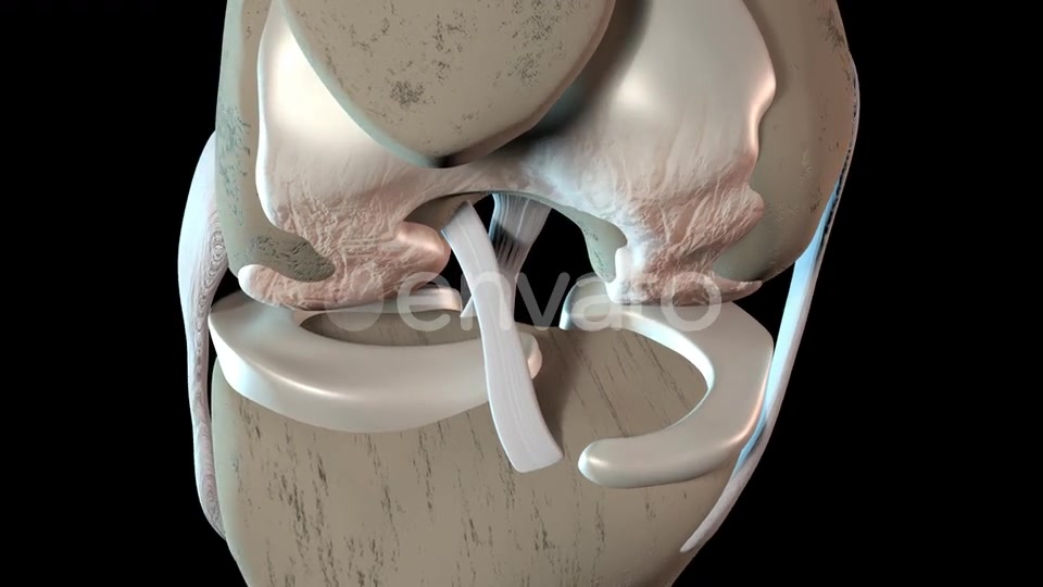 Damage To The Knee Cartilage Tissue Videohive 23324689 Motion Graphics Image 7