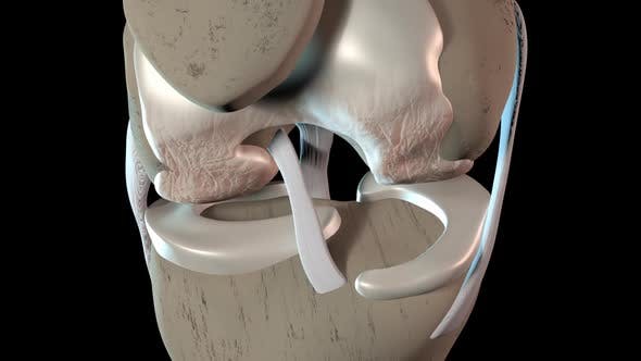 Damage To The Knee Cartilage Tissue - Download 23324689 Videohive