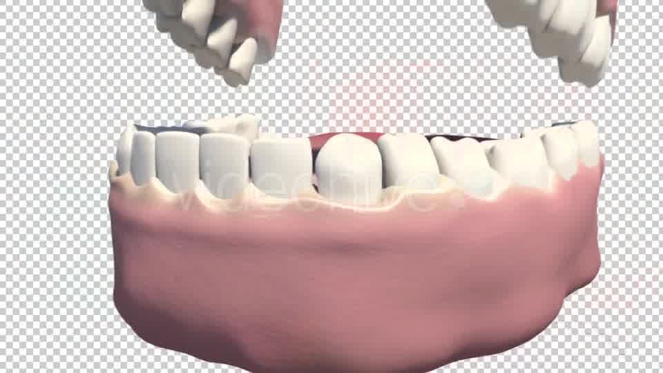 Dental Implants Videohive 19245111 Motion Graphics Image 12