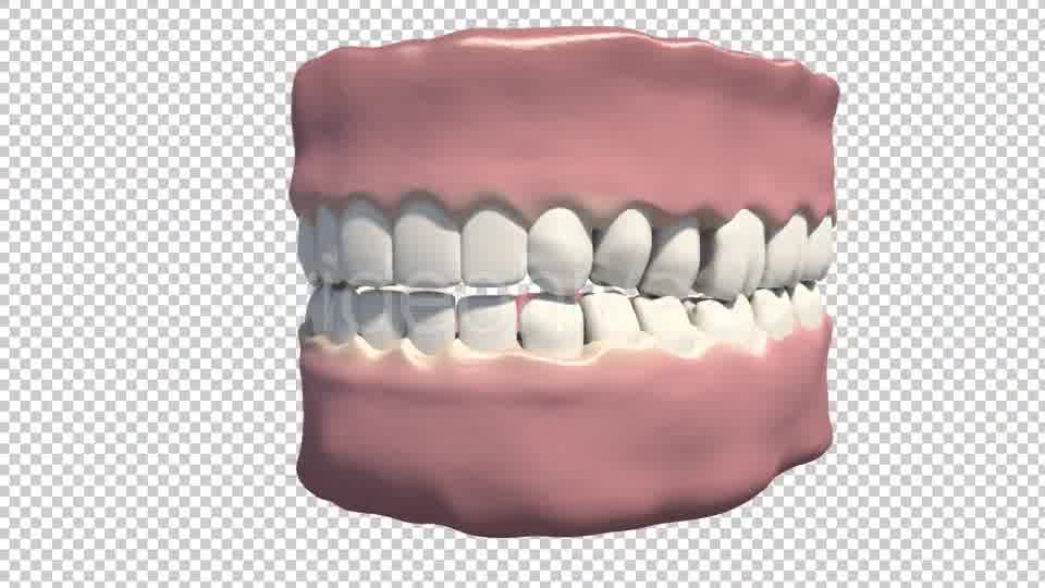 Dental Implants Videohive 19245111 Motion Graphics Image 13