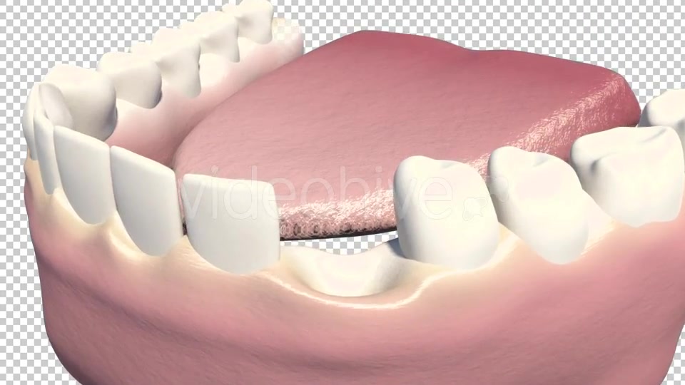 Dental Implants Videohive 19245111 Motion Graphics Image 3