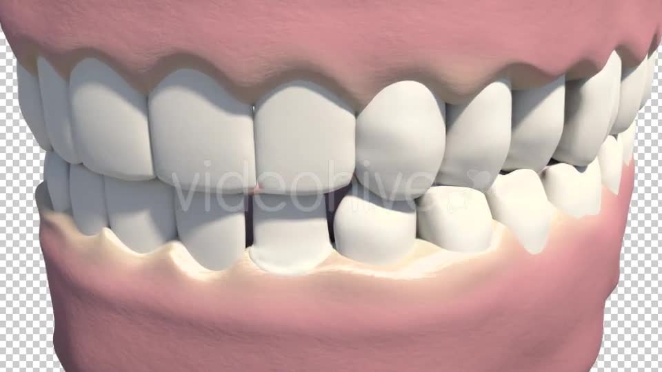 Dental Veneers Videohive 19247397 Motion Graphics Image 1
