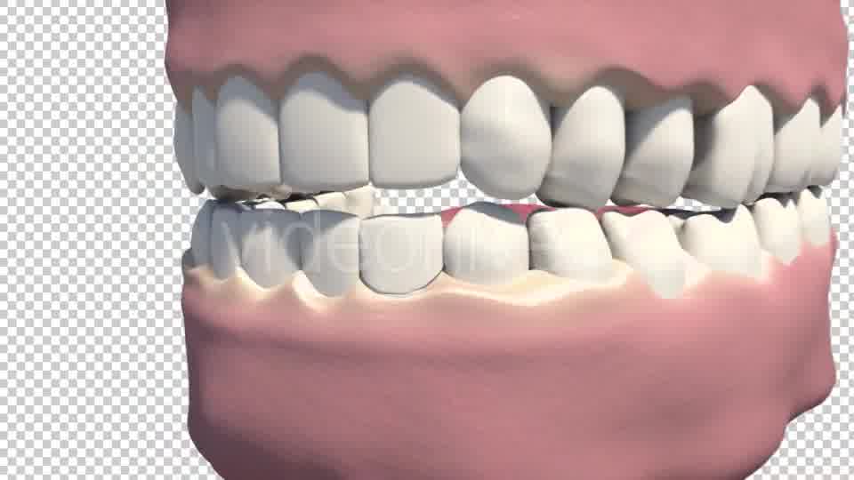 Dental Veneers Videohive 19247397 Motion Graphics Image 12