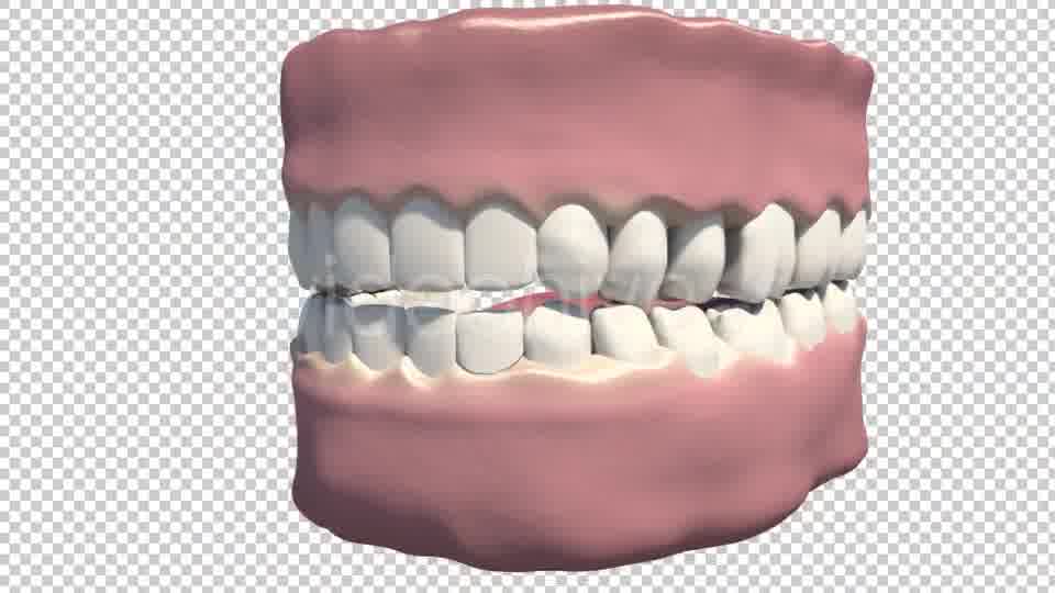 Dental Veneers Videohive 19247397 Motion Graphics Image 13