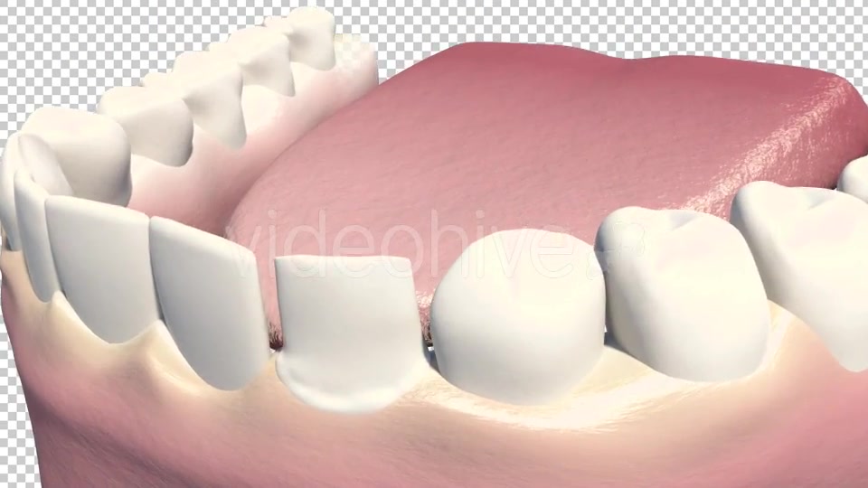 Dental Veneers Videohive 19247397 Motion Graphics Image 3