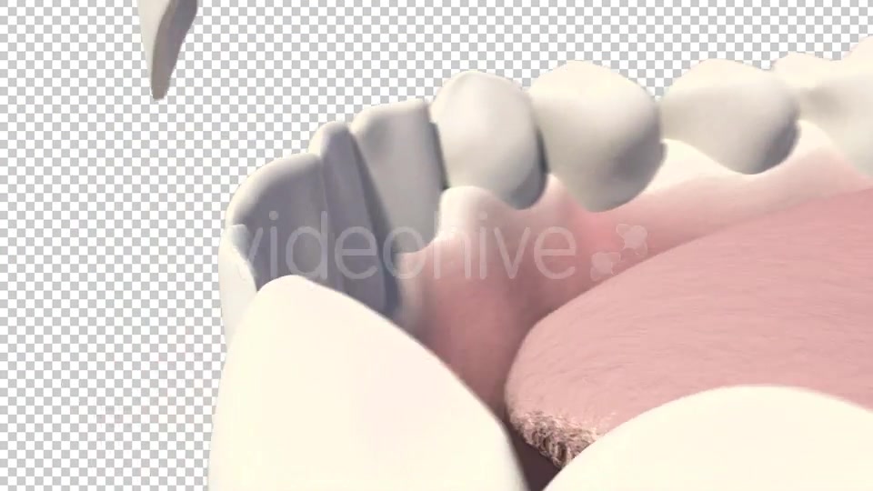 Dental Veneers Videohive 19247397 Motion Graphics Image 6