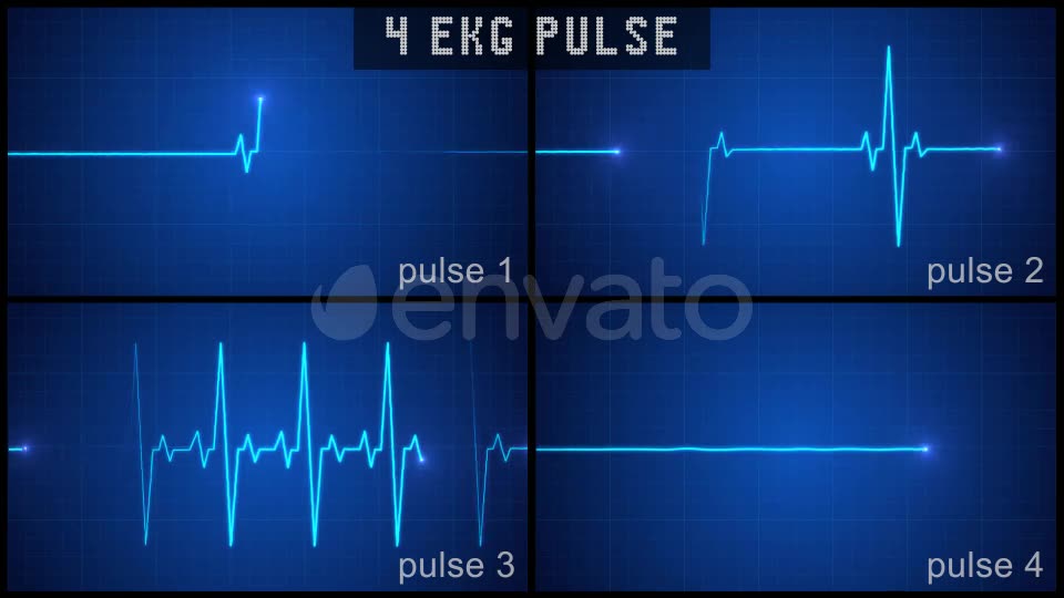 Digital EKG Pulse Display Set Videohive 22367553 Motion Graphics Image 2