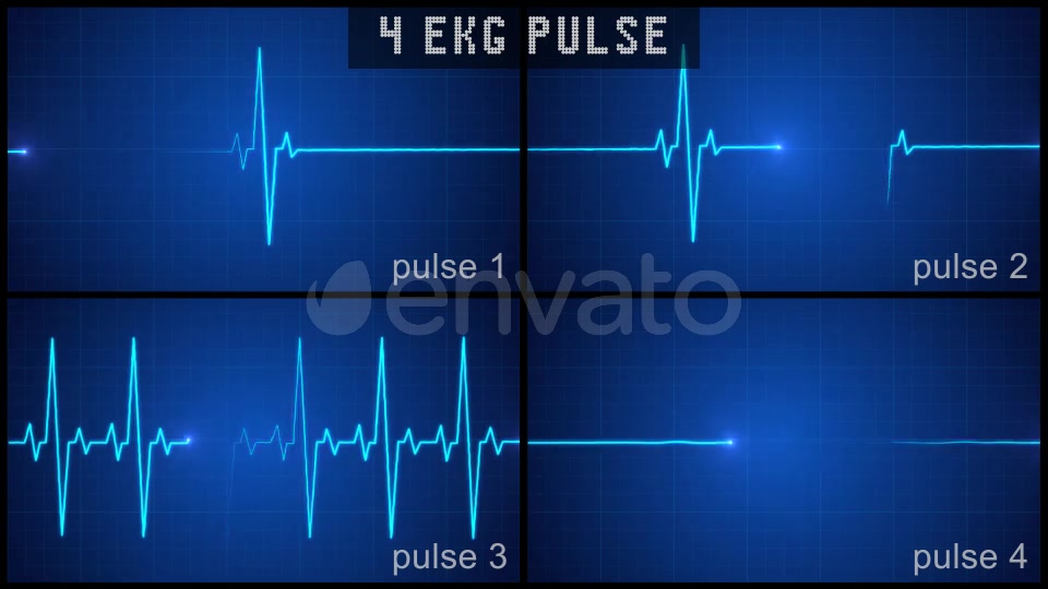 Digital EKG Pulse Display Set Videohive 22367553 Motion Graphics Image 3