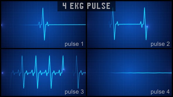 Digital EKG Pulse Display Set - Videohive Download 22367553