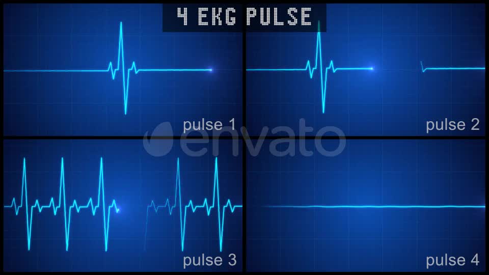 EKG Pulse Display Set Videohive 22414829 Motion Graphics Image 1