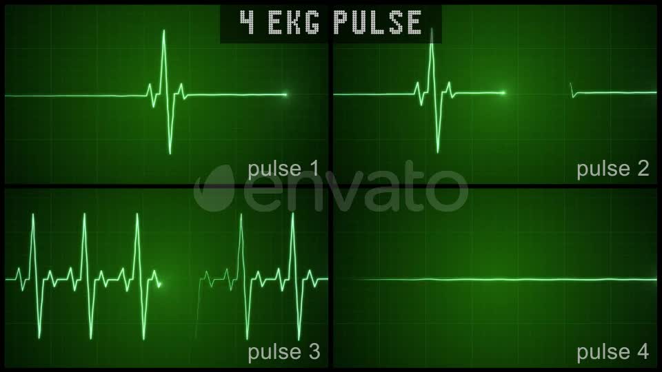 EKG Pulse Set Videohive 22650376 Motion Graphics Image 1