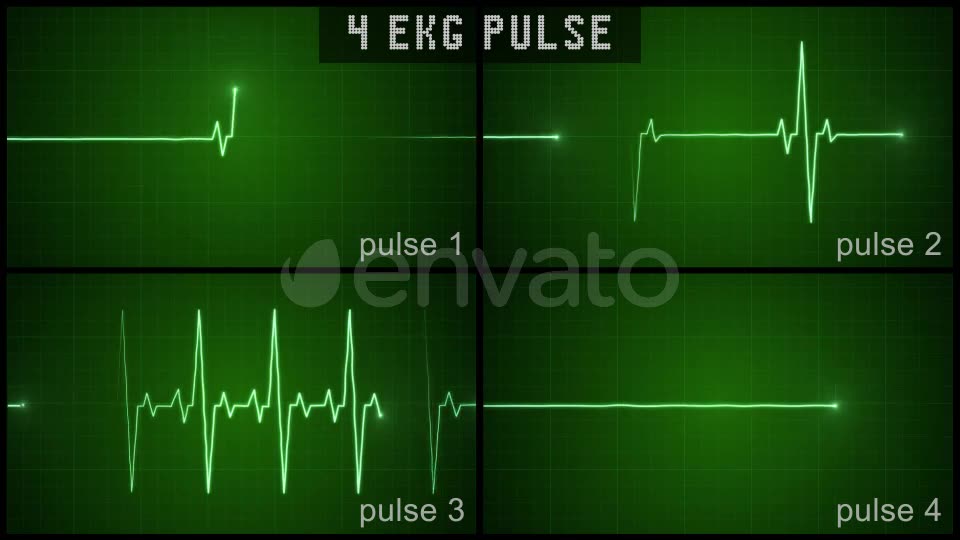 EKG Pulse Set Videohive 22650376 Motion Graphics Image 2
