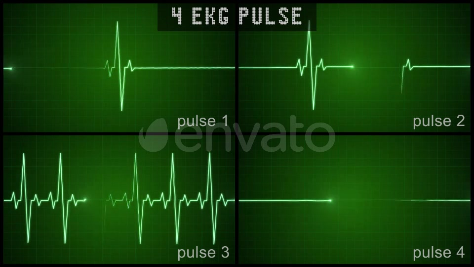 EKG Pulse Set Videohive 22650376 Motion Graphics Image 3
