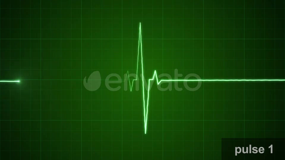 EKG Pulse Set Videohive 22650376 Motion Graphics Image 4