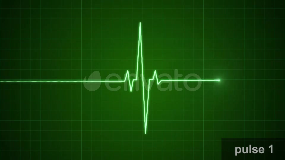 EKG Pulse Set Videohive 22650376 Motion Graphics Image 5