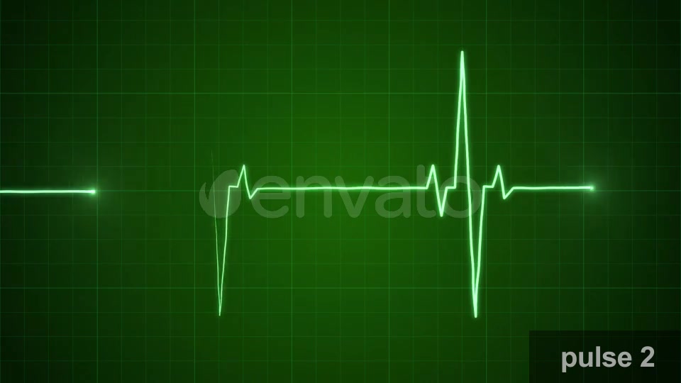 EKG Pulse Set Videohive 22650376 Motion Graphics Image 6