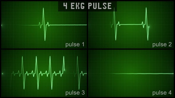 EKG Pulse Set - Videohive 22650376 Download
