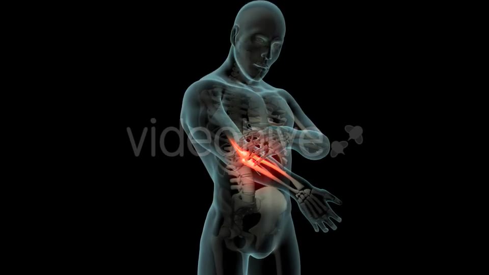 Elbow Pain Videohive 21253430 Motion Graphics Image 2