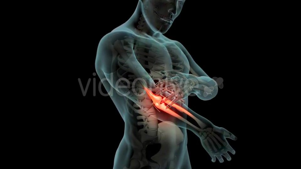 Elbow Pain Videohive 21253430 Motion Graphics Image 4