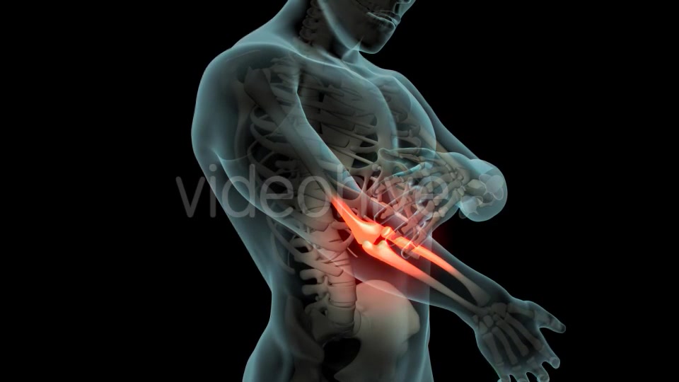 Elbow Pain Videohive 21253430 Motion Graphics Image 6